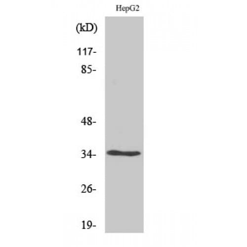 OR52E4 Antibody (170-250 aa, Internal)