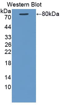 KRT28 / Keratin 28 Antibody (aa1-462)
