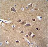 ENO2 / NSE Antibody (Tyr25)
