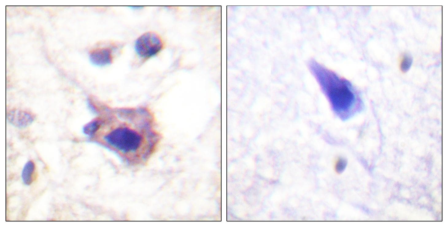 Polyclonal Rabbit anti-Human SYK Antibody (phospho-Tyr323, IHC, IF, WB)