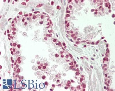 IHC-plus™ SENP3 Antibody (aa1-50)