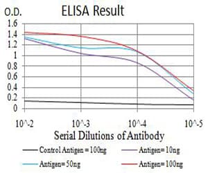 ATRX Antibody (clone 8B2H9)