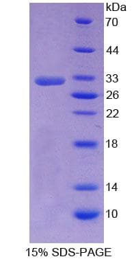 Human NR0B2 Protein (Recombinant His-T7)