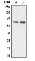 Polyclonal Rabbit anti-Human AATF Antibody (N-Terminus, IHC, IF, WB)