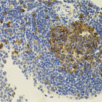 APP / Beta Amyloid Precursor Antibody