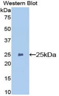 GSTP1 / GST Pi Antibody (aa1-210)