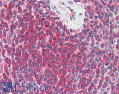 IHC-plus™ Monoclonal Mouse anti-Human IST1 Antibody (IHC, WB)