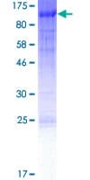 Human FOXN1 Protein (Recombinant GST)