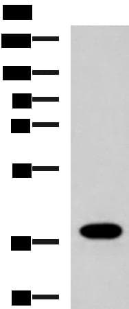 Polyclonal Rabbit anti-Human GPR6 Antibody (IHC, WB)