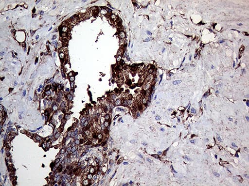 TGM2 / Transglutaminase 2 Antibody (clone OTI4H5, Carrier-free)