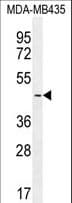 Polyclonal Rabbit anti-Human LEF1 Antibody (aa10-37, IF, WB)