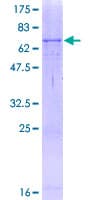 Human Tyrosinase Protein (Recombinant GST)
