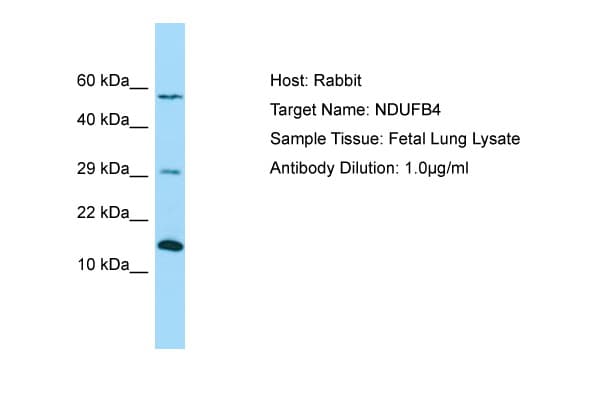 NDUFB4 / B15 Antibody (aa71-120)