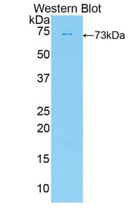 DIO2 Antibody (aa30-259)