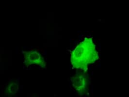 Monoclonal Mouse anti-Human RIP1 / RALBP1 Antibody (clone OTI1E2, IHC, IF, WB)