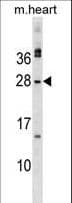 MSC / Musculin Antibody (aa166-194)