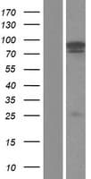 ACIN1 / Acinus Protein (Over-Expression Lysate Myc-DDK (Flag))