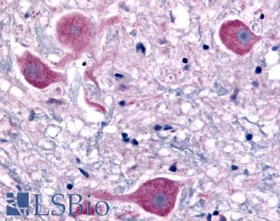 PathPlus™ NTSR2 / NTR2 Antibody (Extracellular Domain)