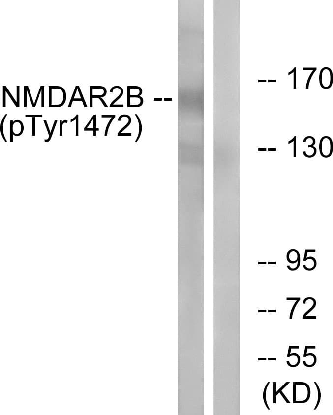 GRIN2B / NMDAR2B / NR2B Antibody (phospho-Tyr1474)