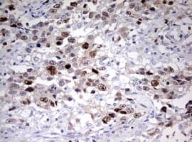 TOP2A / Topoisomerase II Alpha Antibody (aa1100-1531, clone OTI5E6, Carrier-free)