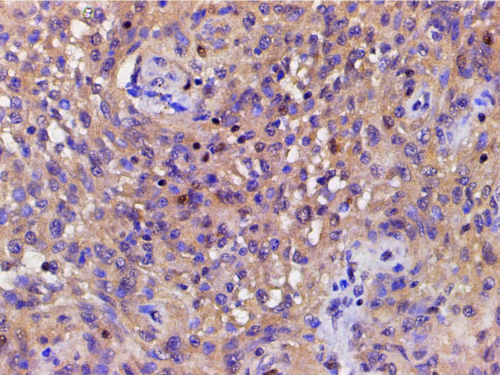 CFL1 / Cofilin Antibody (phospho-Ser3)