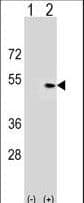 PLEKHA1 Antibody (aa149-178)