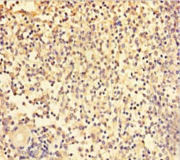 Polyclonal Rabbit anti-Human TRAF5 Antibody (aa1-557)