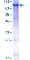 Human AMPD1 Protein (Recombinant GST)