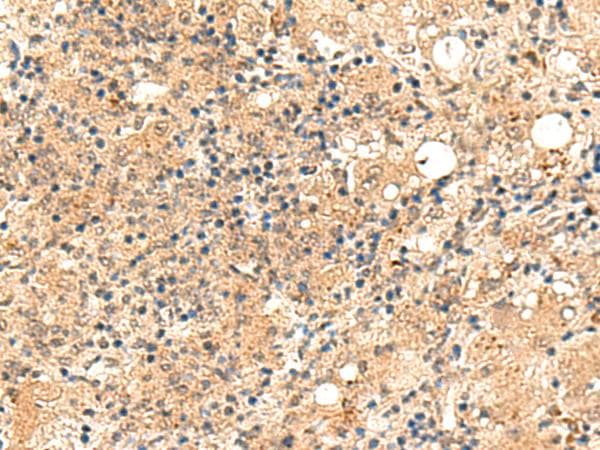 ZFYVE27 / Protrudin Antibody