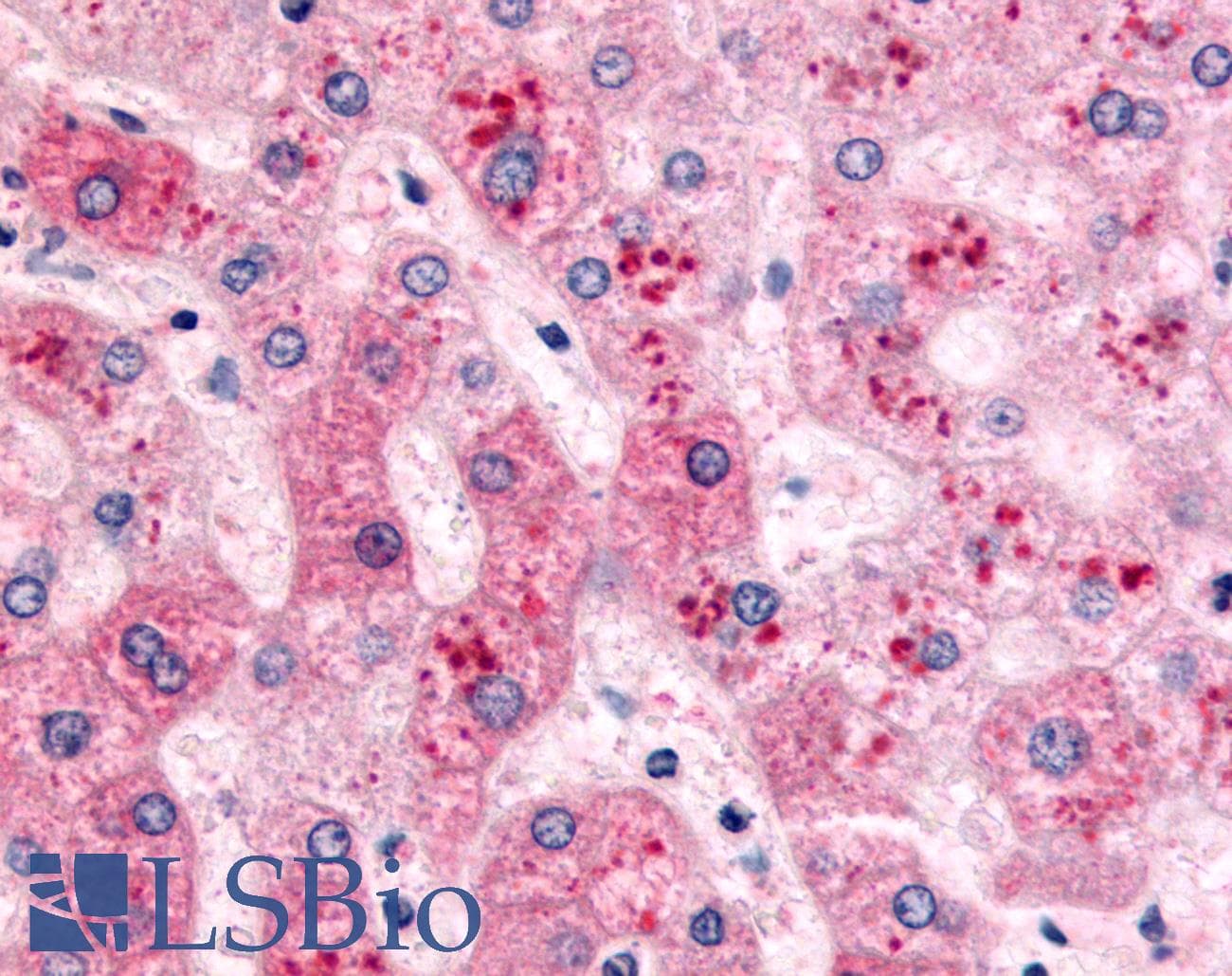IHC-plus™ Polyclonal Rabbit anti-Human PYGL Antibody (C-Terminus, IHC)