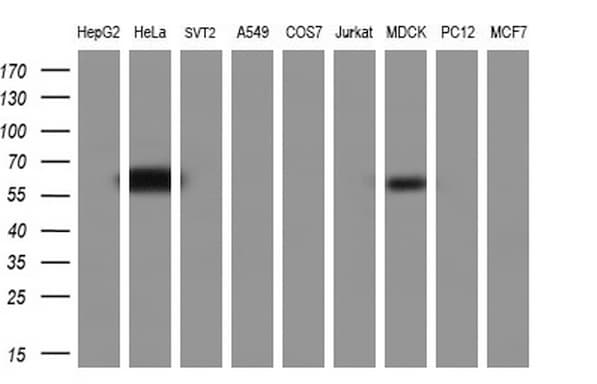 ER Alpha / Estrogen Receptor Antibody (aa1-310, clone OTI5E11)