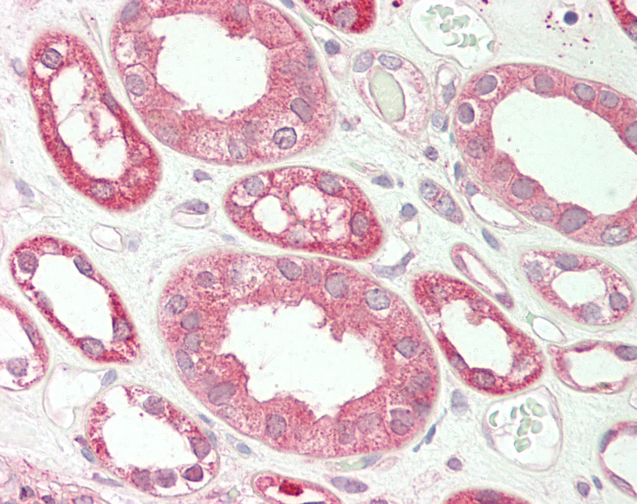 Polyclonal Rabbit anti-Human ALDH7A1 Antibody (aa35-84, IHC, WB)