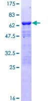 Human PHAP III / ANP32E Protein (Recombinant GST)