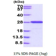 Human FKBP14 Protein (Recombinant His)