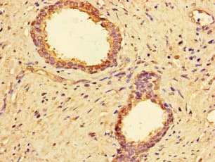 Polyclonal Rabbit anti-Human MMP2 Antibody