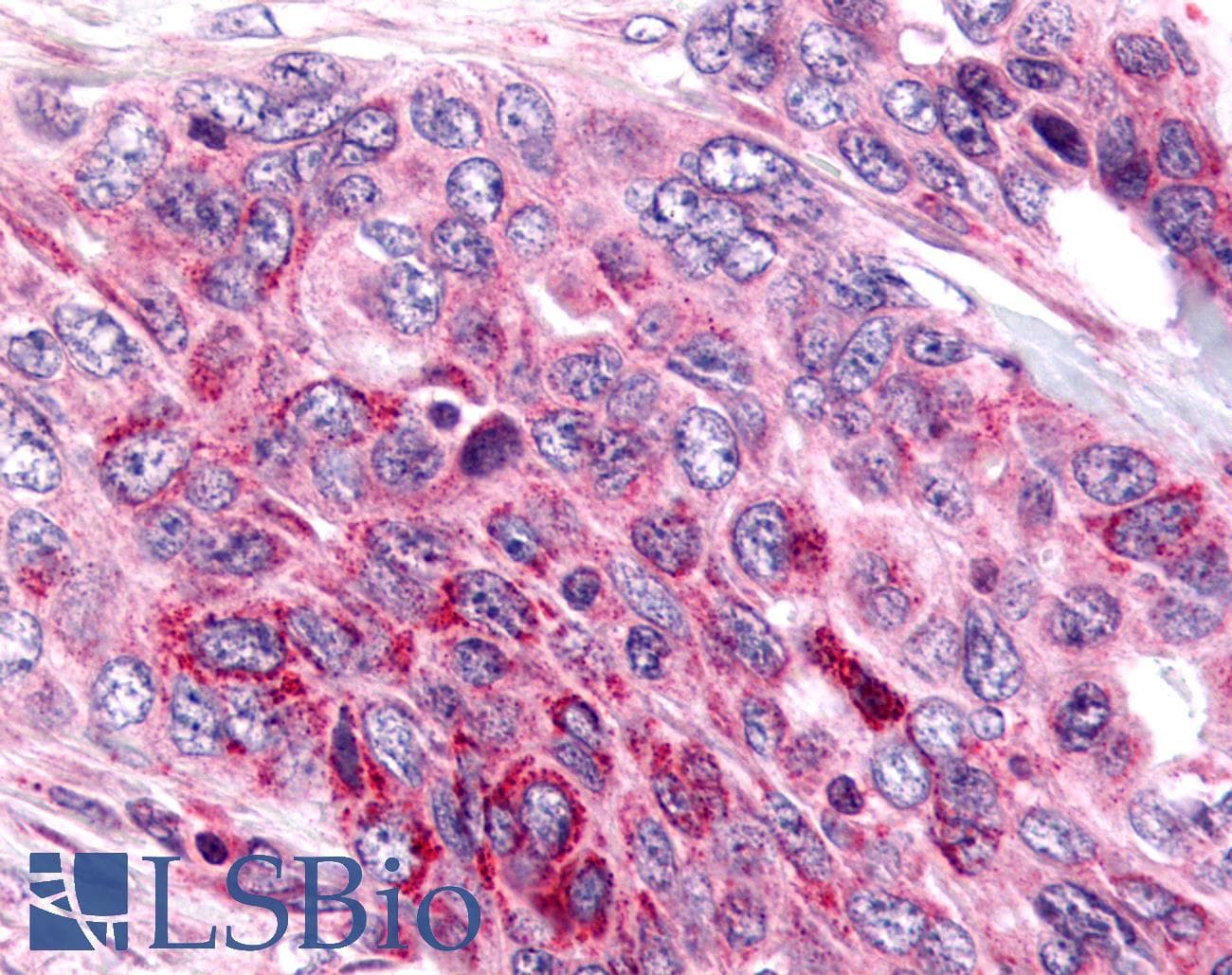 PathPlus™ NEK9 Antibody (Pro/Ser/Thr Rich Domain)