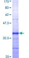 Human CCKBR / Cckb Protein (Recombinant GST, N-terminus)
