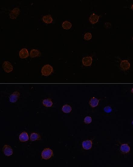 TMEM16B / ANO2 Antibody