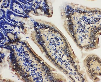 LMNA / Lamin A+C Antibody (aa455-469)