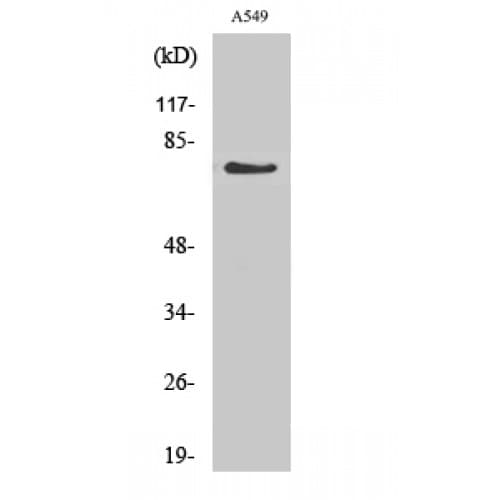 Polyclonal Rabbit anti-Human GUCY1A1 / GUCY1A3 Antibody (Internal, IHC, WB)