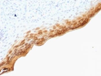 FLG / Filaggrin Antibody (clone SPM181)