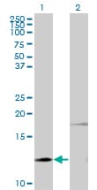 PTH / Parathyroid Hormone Antibody (clone 3G9)