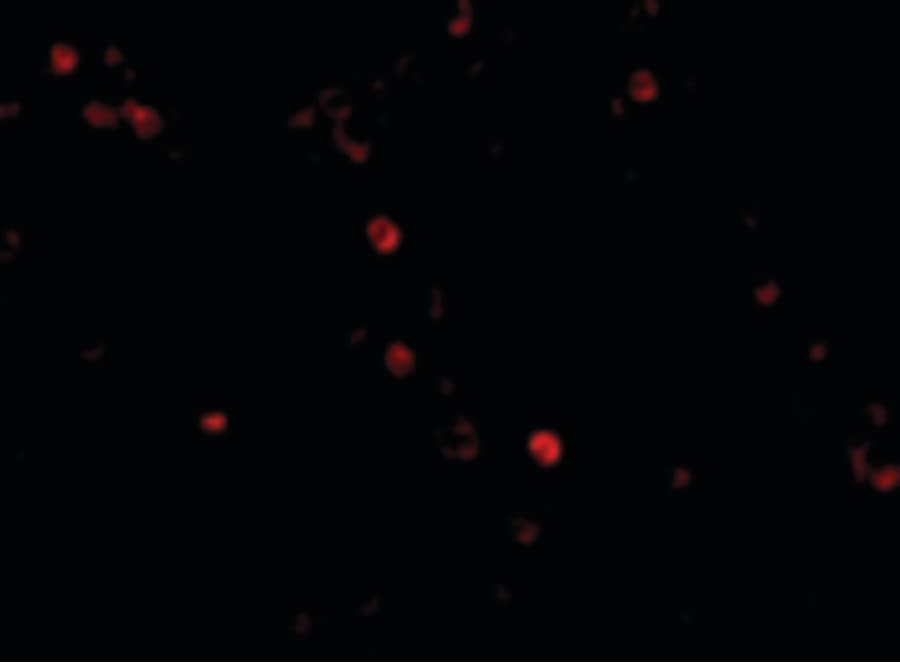 IHC-plus™ IFIH1 / MDA5 Antibody