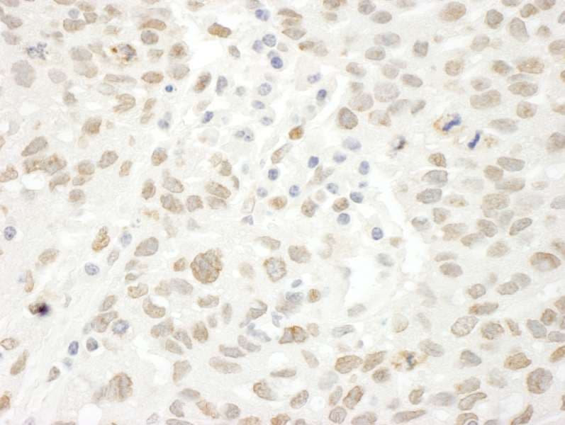 ARID4B Antibody (aa125-175)