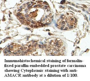 AMACR / P504S Antibody
