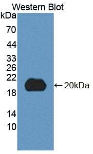 DNT / NT5C Antibody (PE)