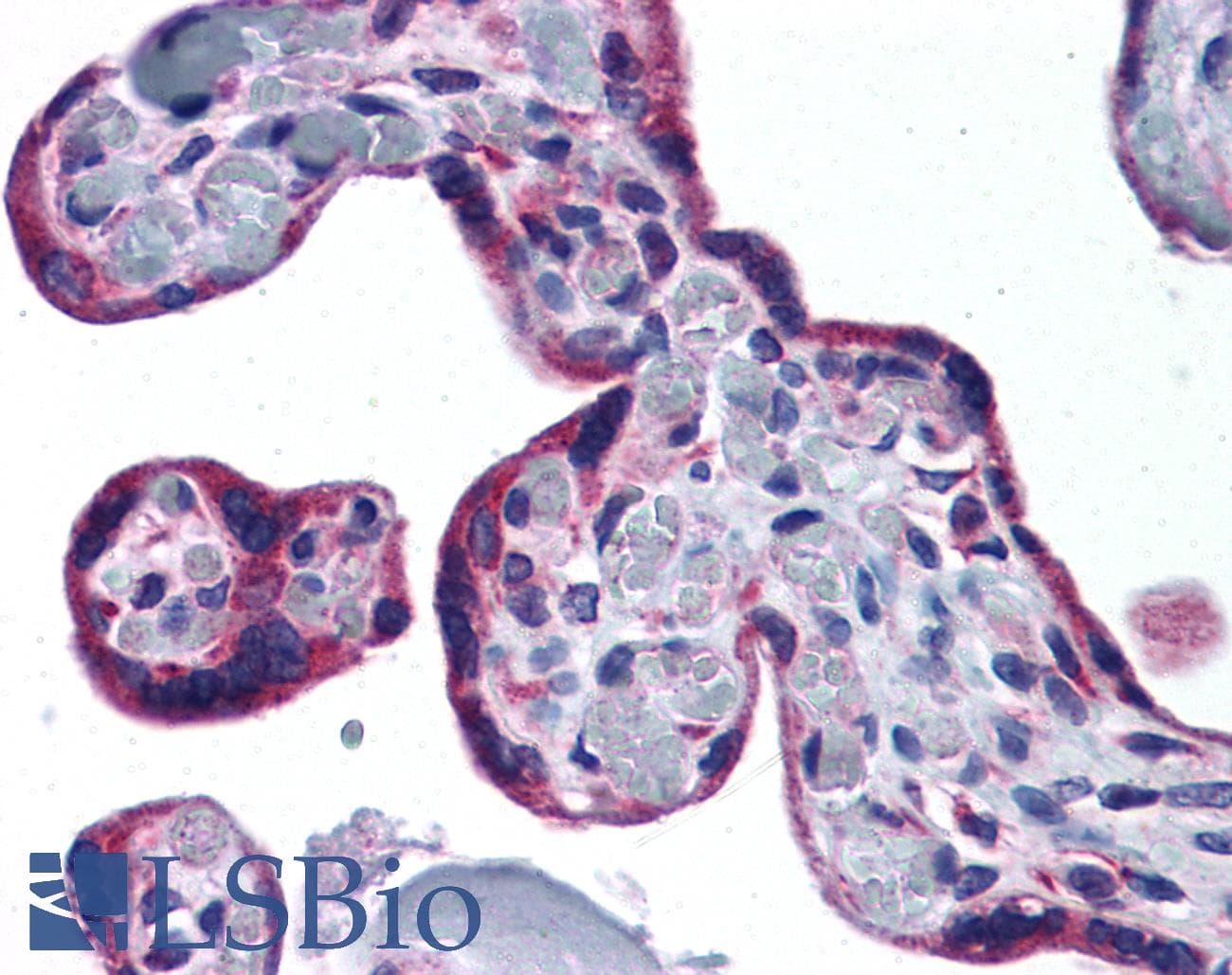 IHC-plus™ PTHR / PTHR1 Antibody (aa145-194)