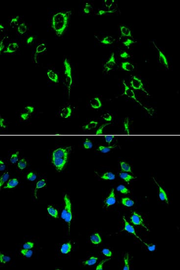 APOBEC3G / CEM15 Antibody