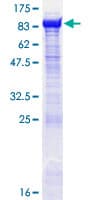 Human OGFOD1 Protein (Recombinant GST)