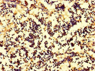 IL17A Antibody